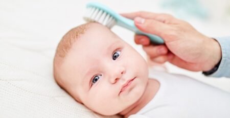 Baby with cradle cap lying on bed while parent brushes hair